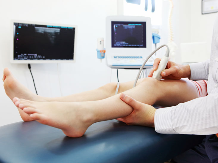 Various vericose vein treatments